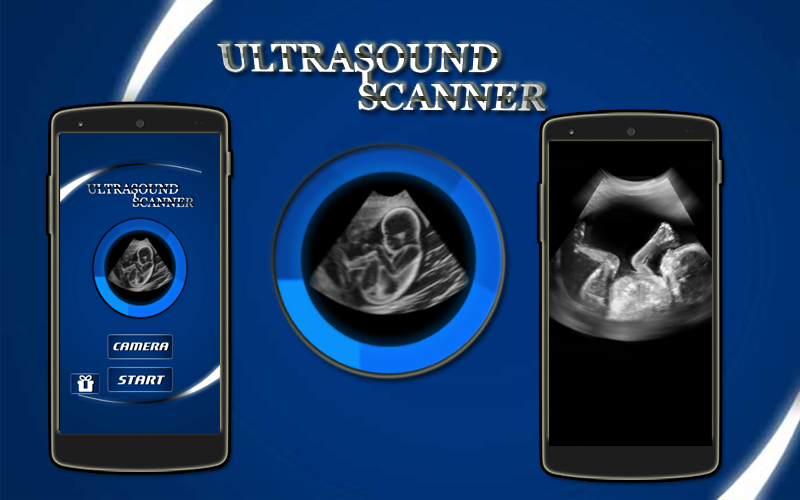 Ultrasound Scanner (Prank) 1.10 APK