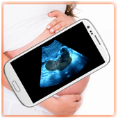 Ultrasound Scanner (Prank) 1.10 APK